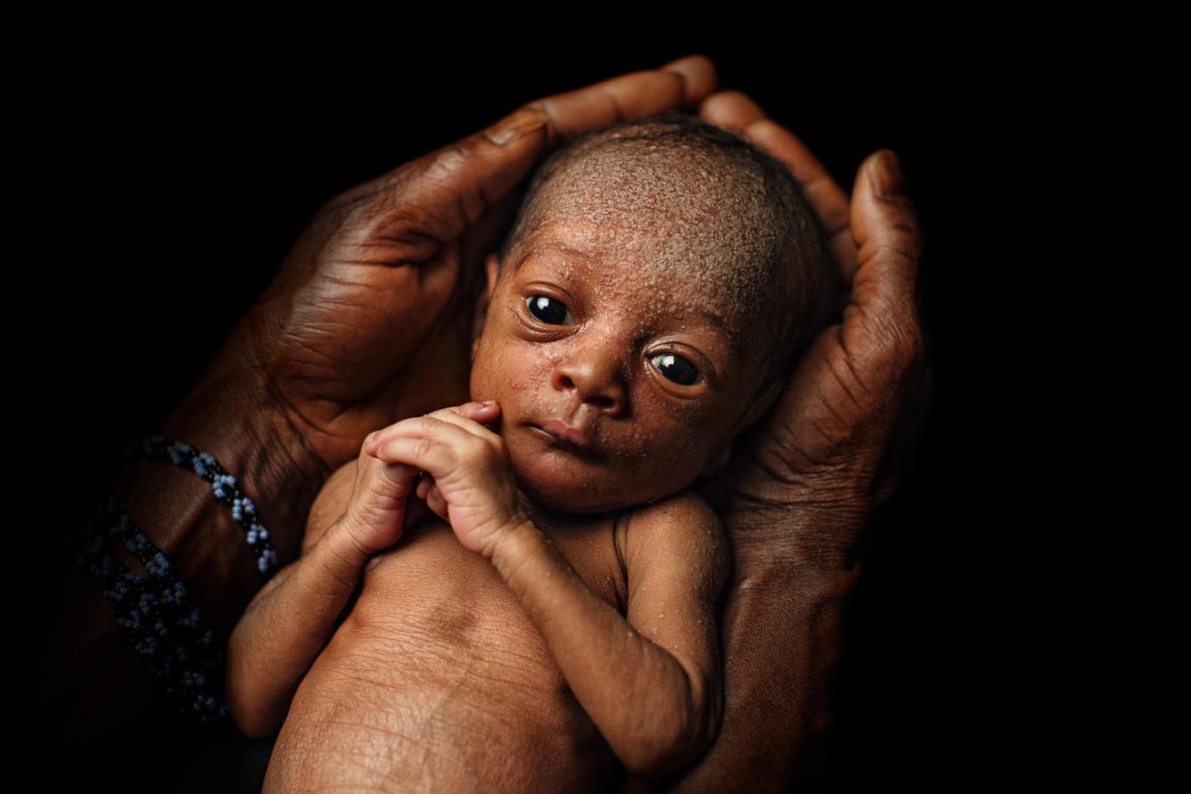 Une Chance De Vivre Naitre Premature Et Devenir Un Bebe Heureux Et En Bonne Sante Unicef Canada Pour Chaque Enfant