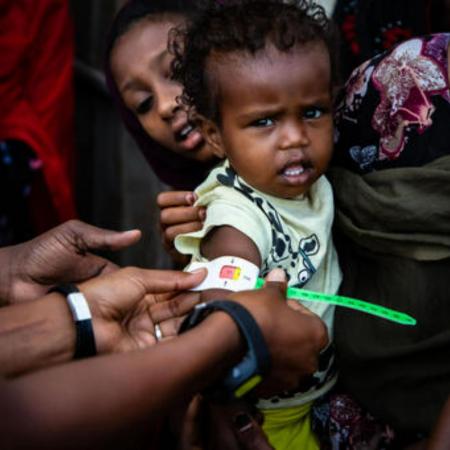 A health worker screens a young girl with a MUAC (Mid-Upper Arm Circumference) bracelet